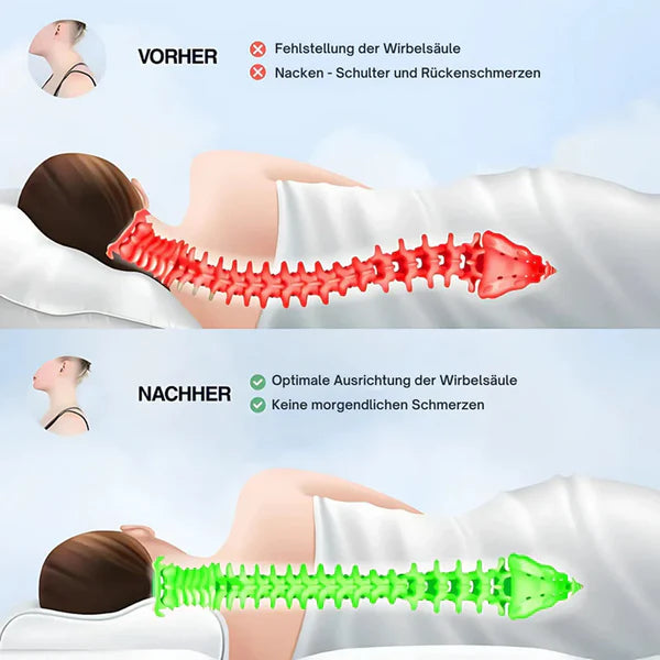 Orthopädisches Nackenkissen – DailyComfort